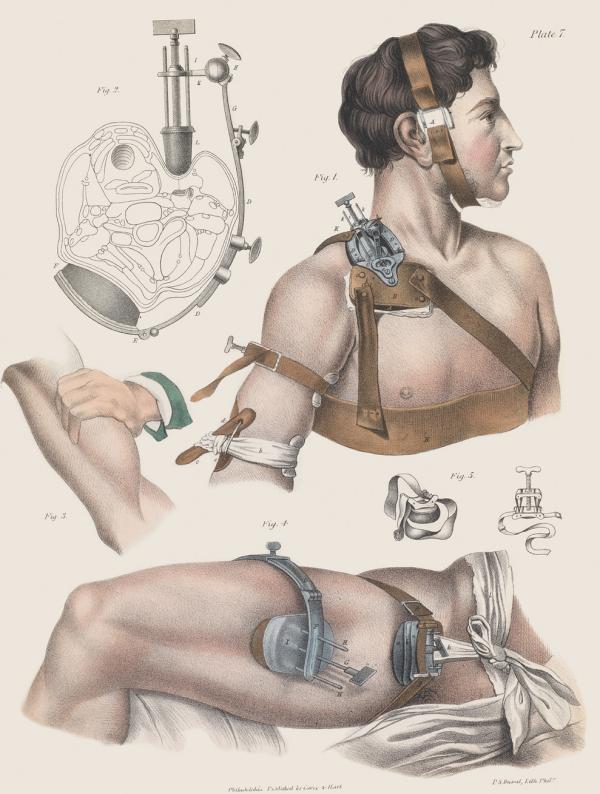 这些19世纪的外科手术图画，会不会让你庆幸自己活在现代？