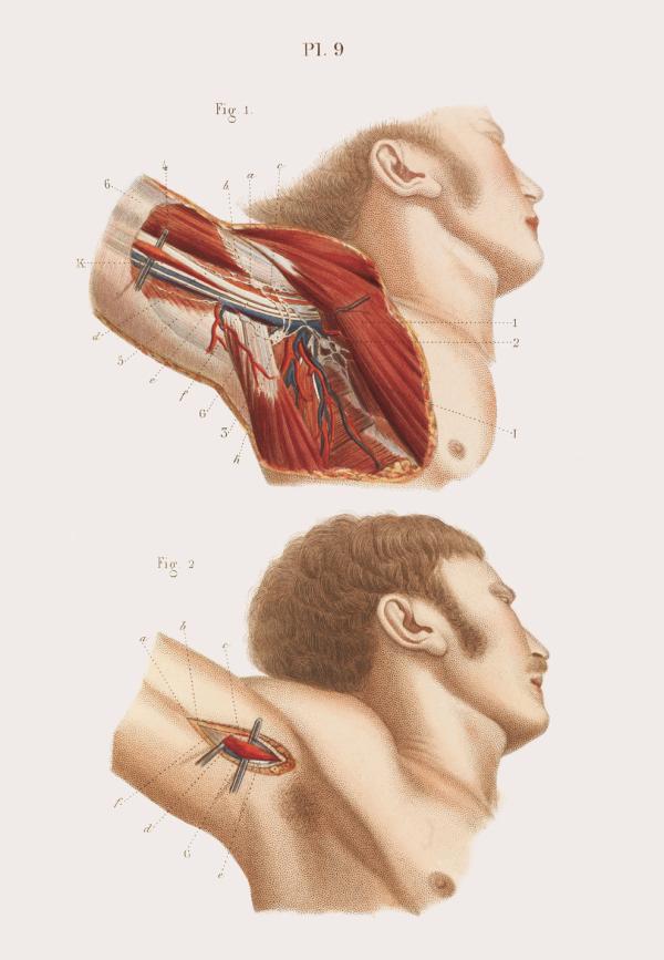 这些19世纪的外科手术图画，会不会让你庆幸自己活在现代？