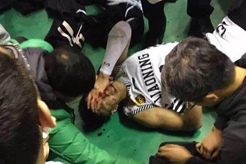 CBA球迷的戾气为何这么重？满面鲜血的郭艾伦该向谁讨公道