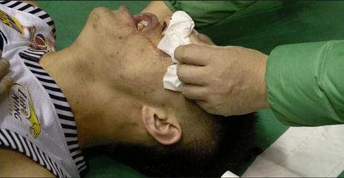 CBA球迷的戾气为何这么重？满面鲜血的郭艾伦该向谁讨公道