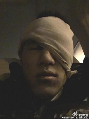 CBA球迷的戾气为何这么重？满面鲜血的郭艾伦该向谁讨公道