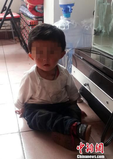 “瓷娃娃”们均身材瘦小，不能直立行走，只能在地上爬行坐卧。　佘丽莎 摄