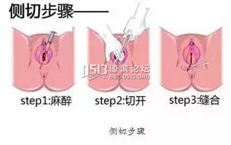 顺产全过程真实现场实拍