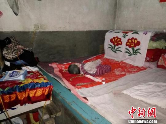 山西5岁女童患脑瘫似1岁婴儿发育落后不足20斤