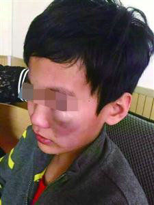 小学生逃课遭老师殴打 老师:他打骂我在先(图)