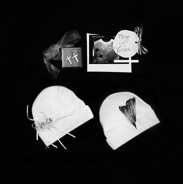 11次流产后，母亲拍下令人心碎的照片记录那些短暂的生命