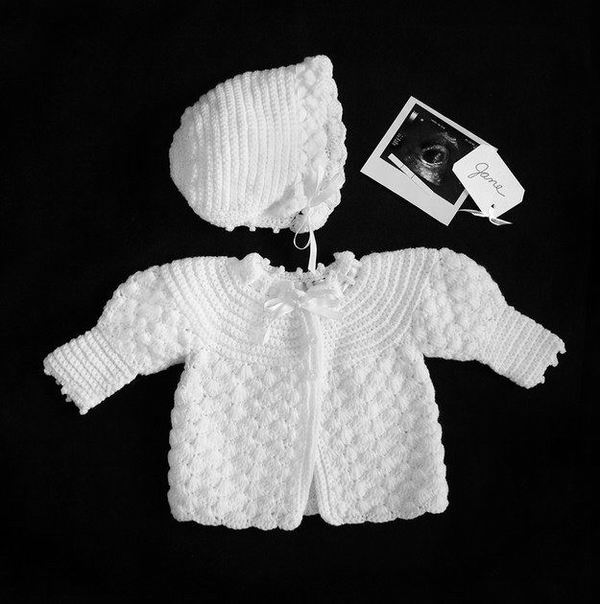 11次流产后，母亲拍下令人心碎的照片记录那些短暂的生命