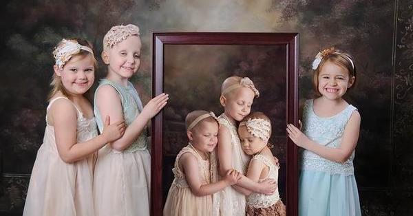 “滚蛋吧！肿瘤君”，这3个充满勇气的小女孩温暖了全世界