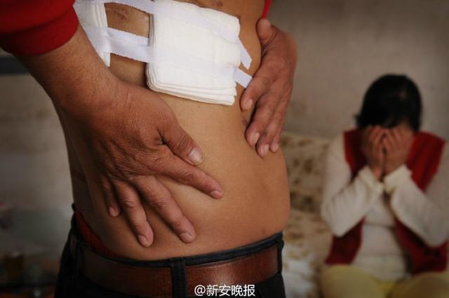 做个手术真的能把肾做丢吗？