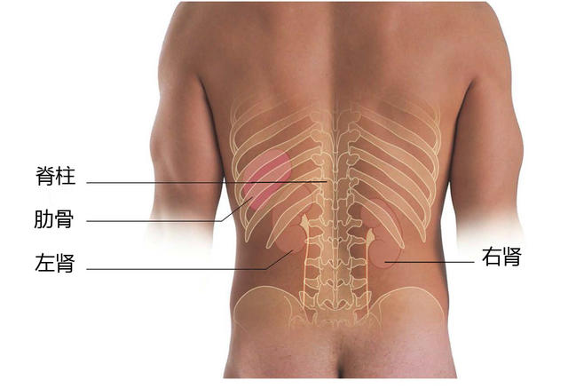 做个手术真的能把肾做丢吗？