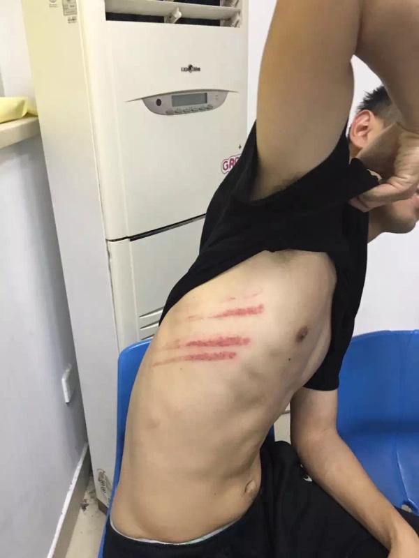 足协杯爆发大规模冲突！业余球队武汉宏兴围攻江苏苏宁