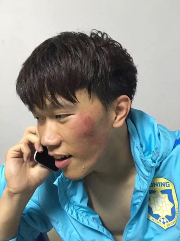 足协杯爆发大规模冲突！业余球队武汉宏兴围攻江苏苏宁