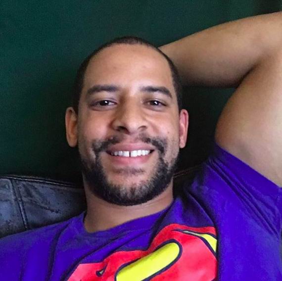 有牙缝的人生，也可以笑得很灿烂