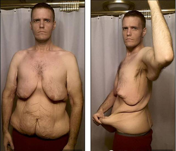 如何减掉354斤肥肉？遇到一个贴心的她，然后不停地跑