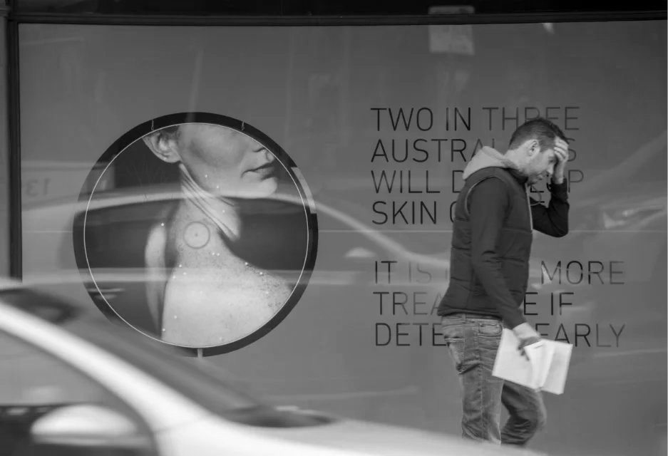 英语翻译：澳大利亚有三分之二有可能患皮肤癌，早发现、早治疗更容易治愈。