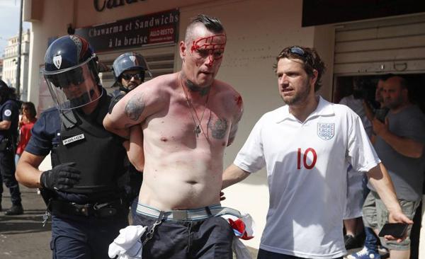 欧洲杯也成了“放开打”，法国警方的强硬助长了足球流氓？