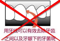 美卫生署不再建议使用牙线？清洁牙齿，你还需要它
