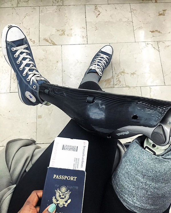 截肢女孩成为时尚博主，只有自己能决定自己的价值