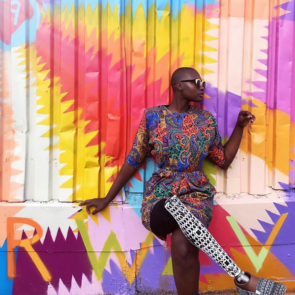 截肢女孩成为时尚博主，只有自己能决定自己的价值