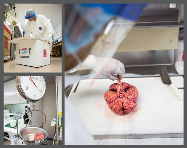 我靠解剖人脑为生