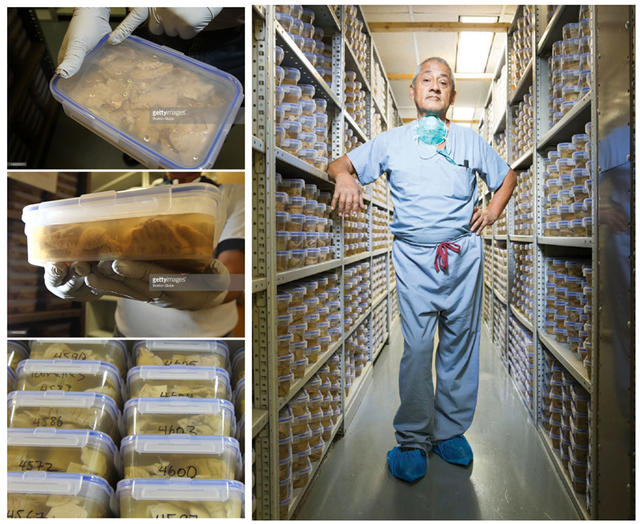 我靠解剖人脑为生