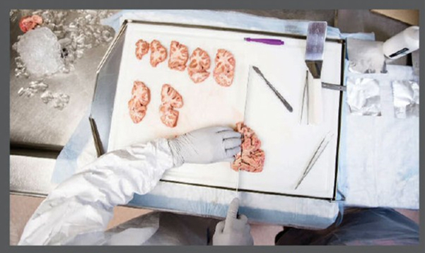 我靠解剖人脑为生