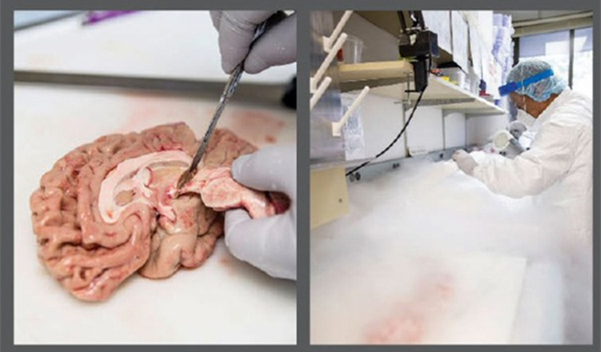 我靠解剖人脑为生