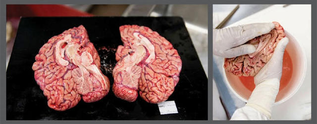 我靠解剖人脑为生