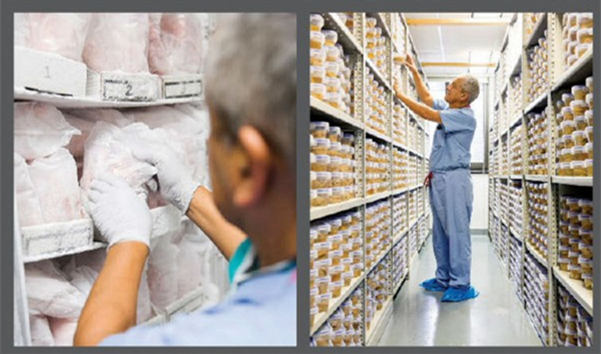 我靠解剖人脑为生