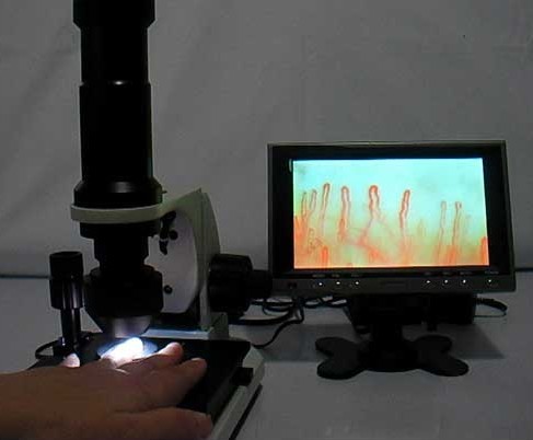 一到冬天就“血流不畅”？微循环障碍可不是这么回事