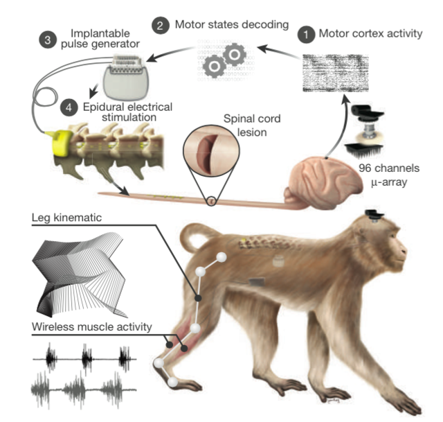 脑机接口：让瘫痪的猴子重新行走！