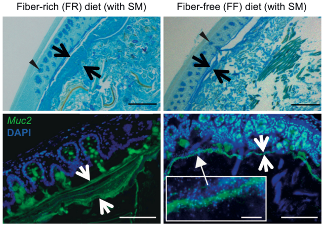 膳食纤维吃不够，后果可能很严重