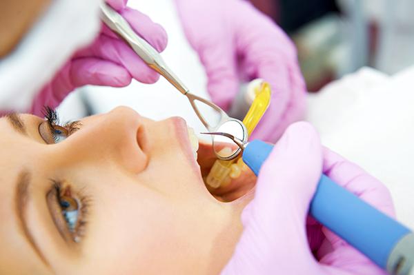 专访丨蒋欣泉：口腔修复并非越贵越好，切勿陷入“两个极端”