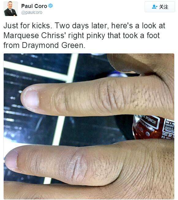 格林是故意的吗？对手妻子求他别再踢裆，“我们还想要孩子”