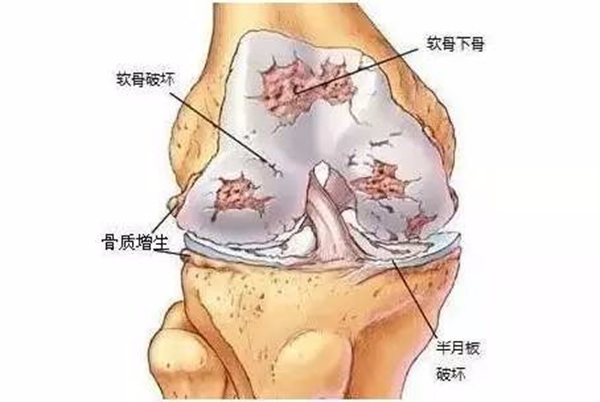 最新膝盖使用说明书，不收藏太亏啦