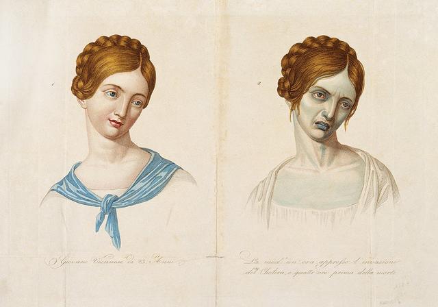 当传染病被消灭，女性地位也在提升