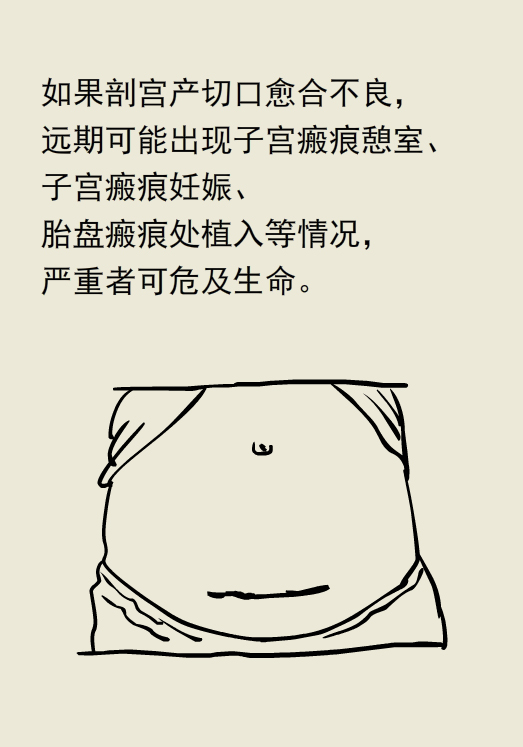 漫画丨顺产剖腹产怎么选？各有各的优缺点
