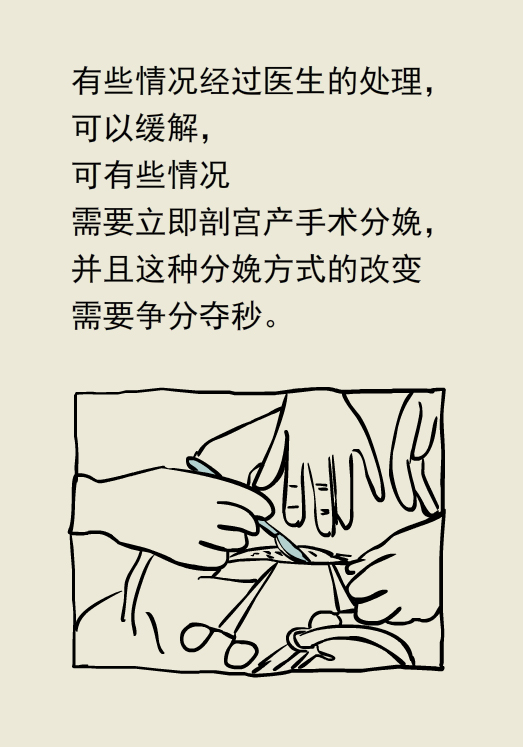 漫画丨顺产剖腹产怎么选？各有各的优缺点