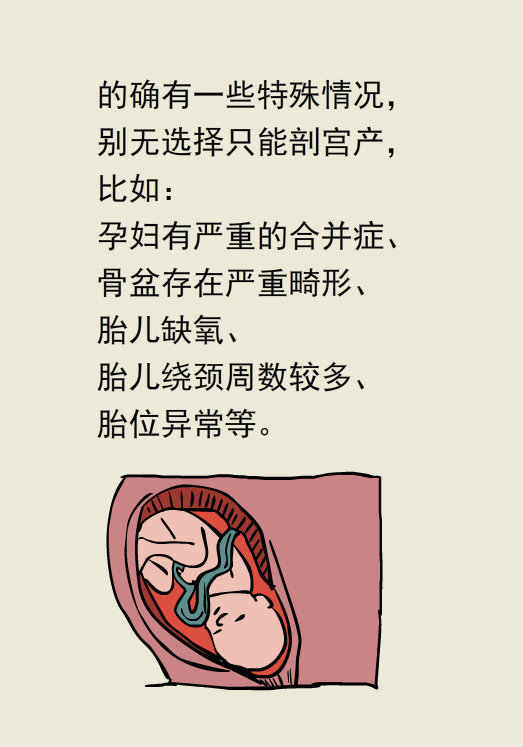 漫画丨顺产剖腹产怎么选？各有各的优缺点