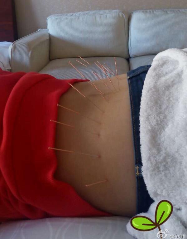 对话“励志姐”彭帅：现在每周扎100针，今年心愿是不受伤