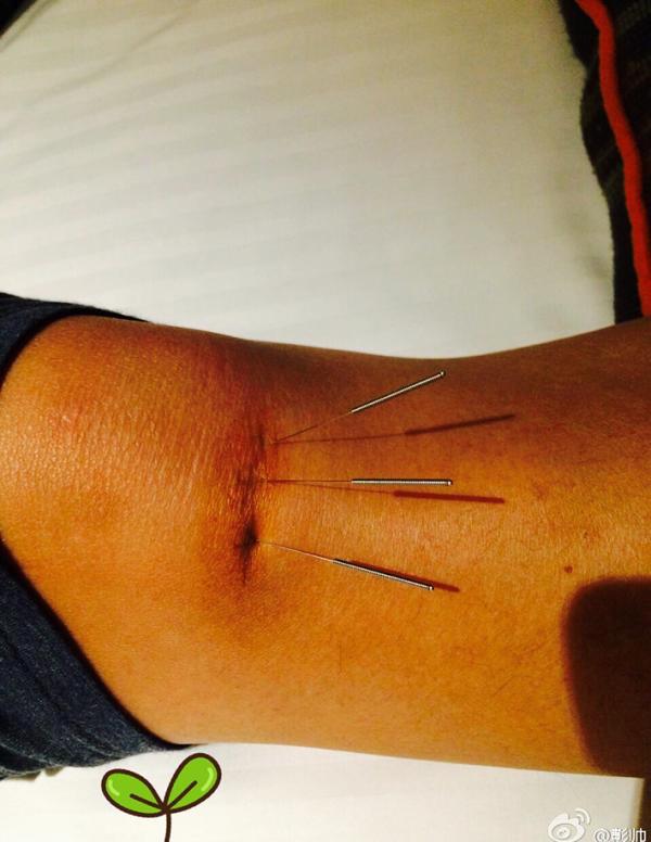 对话“励志姐”彭帅：现在每周扎100针，今年心愿是不受伤