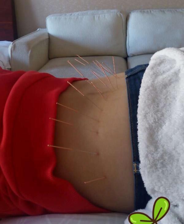 彭帅晋级澳网女双决赛！她现在每周还要扎100针治伤