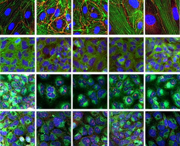 无需了解病理机制，这家公司通过对比细胞图像直接寻找药物
