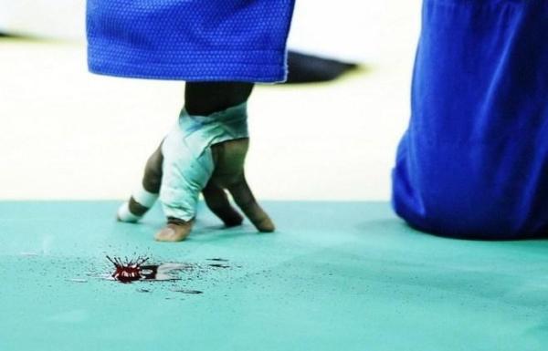 细数中国11幅体育类荷赛奖作品：大家为啥都爱拍体操