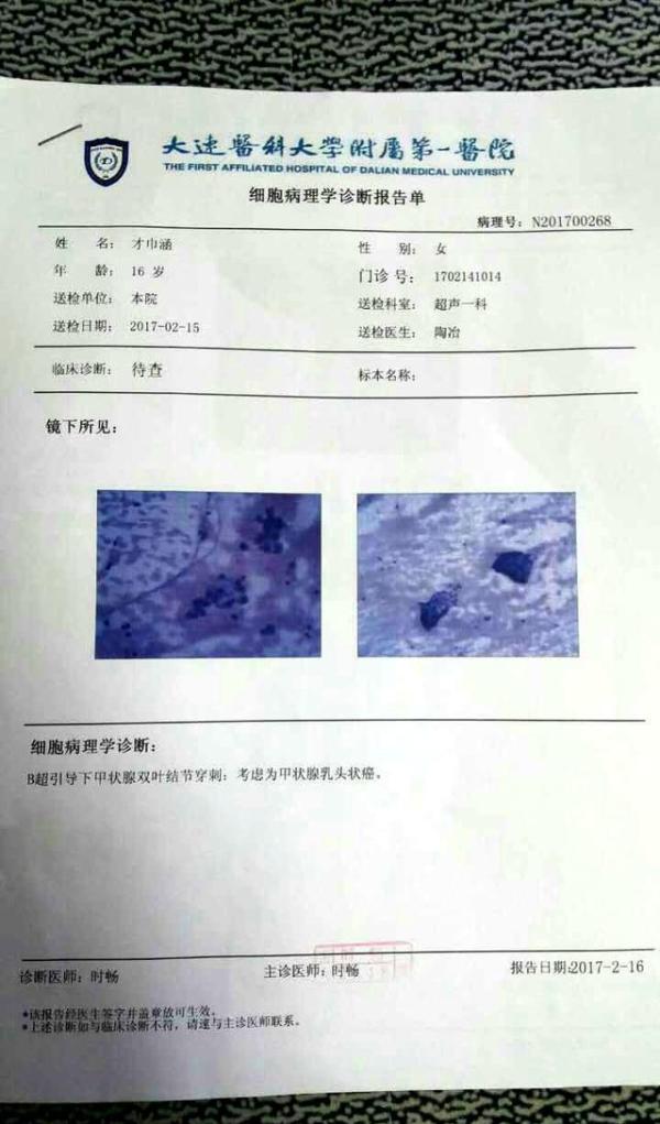 真实生活还原，举重冠军之女众筹背后“举不起的重”