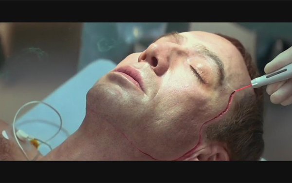 澎湃联播|世上没有速成的微整形培训，只有超神的P图软件