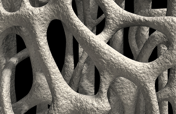 骨质疏松常被忽视，高蛋白饮食易致钙流失