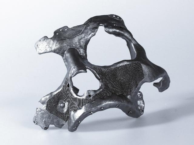 想和金刚狼一样钢筋铁骨？你有两条路可以选