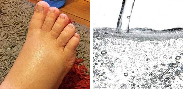 胸胀脚肿、肚子太沉……准妈妈分享缓解“小偏方”