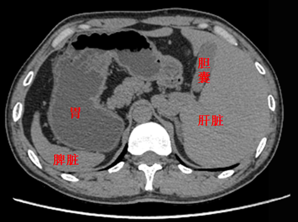 父亲捐肝救女竟是“镜面人”，上海医生“反手”实施肝移植